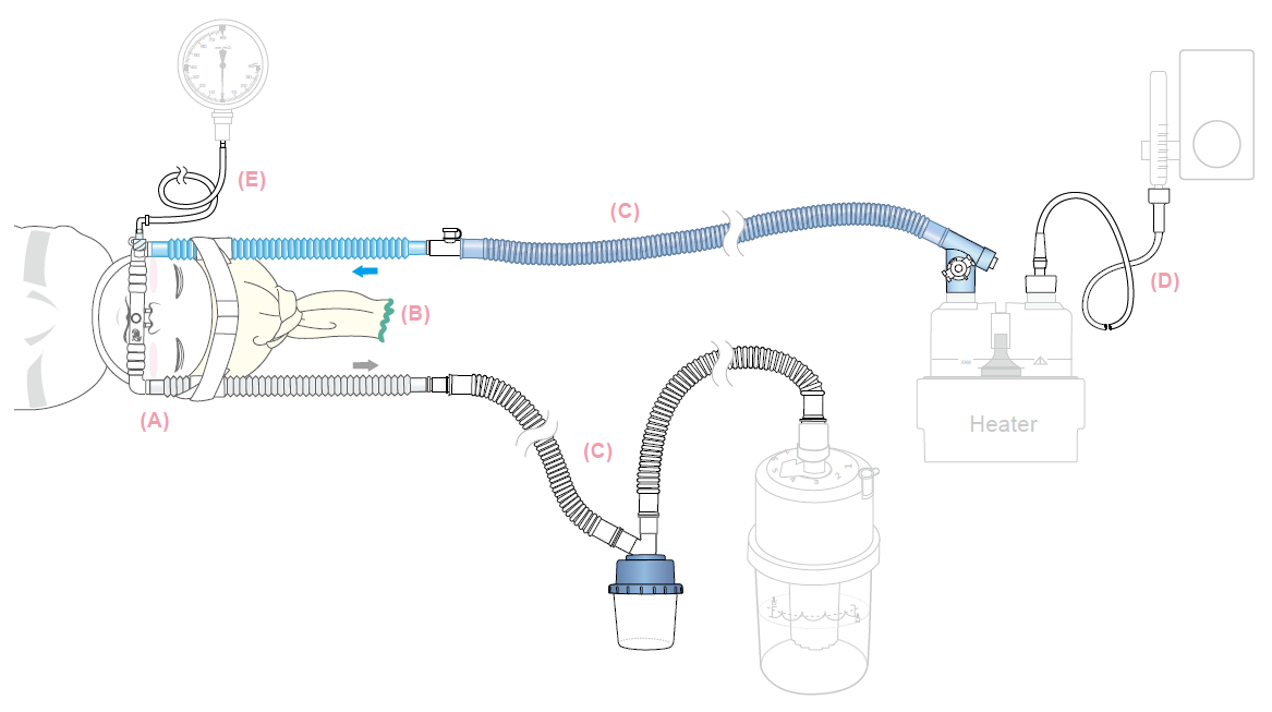 nBubble CPAP Cannula Set
