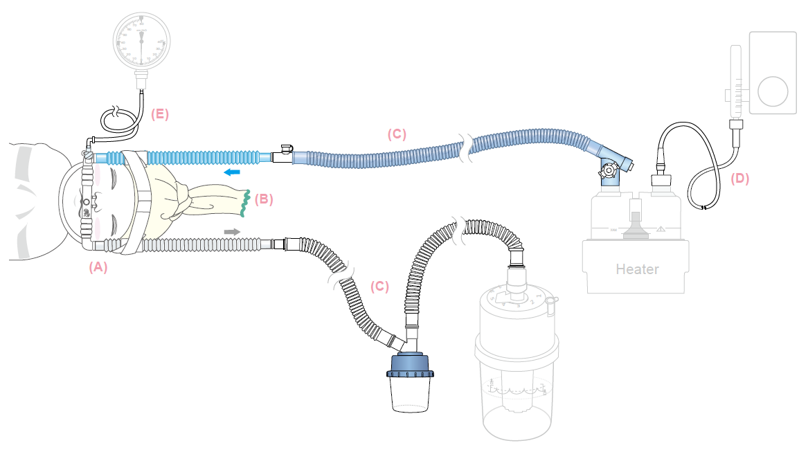 乳児用バブル CPAP 鼻腔カニューレ